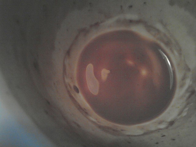 Chocolat commis d'office